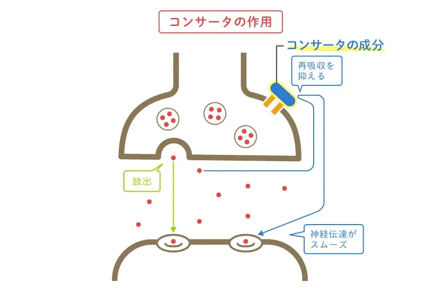 ADHD（注意欠如多動症）のある人に処方される薬コンサータの効果や副作用、コンサータとストラテラ違いも解説【精神科医監修】のタイトル画像