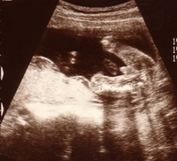 自閉症の息子妊娠中、出生前診断を受けた私--母より背が高くなった21歳の息子を見ながら思うことのタイトル画像