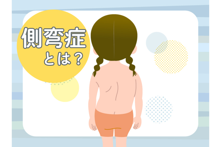 側弯症治療の最前線 基礎編　日本側彎症学会 側弯症治療の最前線 基礎編 | 日本側彎症学会 |本 | 通販 | Amazon