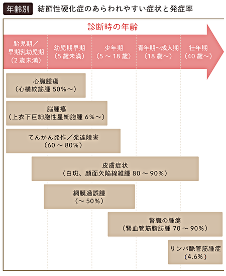 結節性硬化症とは 症状や原因 診断基準 治療法 医療費の助成などの支援まで詳しく紹介 Litalico発達ナビ