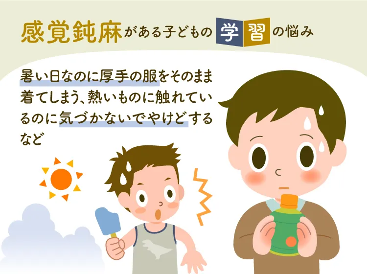 感覚鈍麻があると、暑い日に厚手の服をそのまま着てしまう、熱いものに触れていても気付かずやけどするなどがあります。(監修：作業療法士・野田 遥先生）