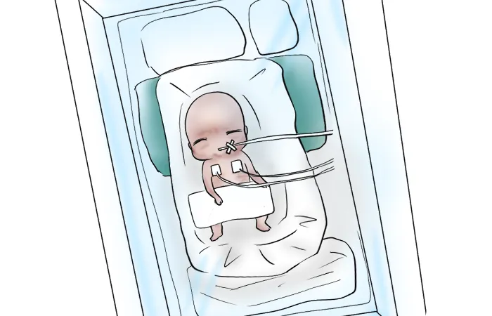 在胎27週930グラムで生まれた息子のねこ太。