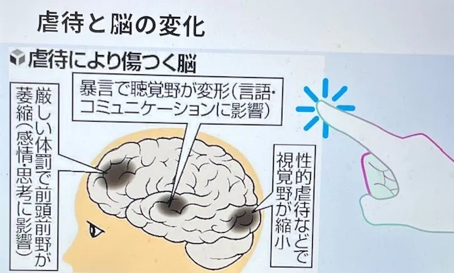 GeniusDiscovery湘南台教室/虐待により傷つく脳